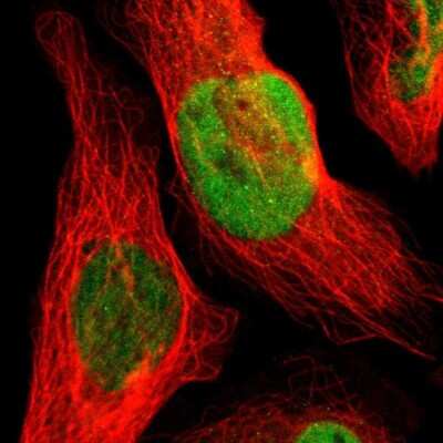 Immunocytochemistry/ Immunofluorescence: Ocular development associated gene Antibody [NBP1-92219]