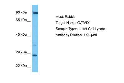 Western Blot: Ocular development associated gene Antibody [NBP2-87980]