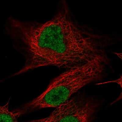 Immunocytochemistry/ Immunofluorescence: Olfactomedin-2/Noelin-2 Antibody [NBP2-56884]