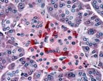 Immunohistochemistry-Paraffin: Olfactory Receptor OR2A4 Antibody - BSA Free [NLS3900]