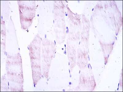 Immunohistochemistry: Olig2 Antibody (1G11) - BSA Free [NBP2-37636]