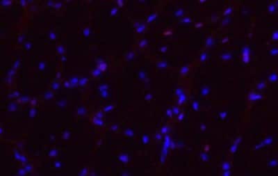 Immunocytochemistry: Olig2 Antibody (3C9) [H00010215-M03]