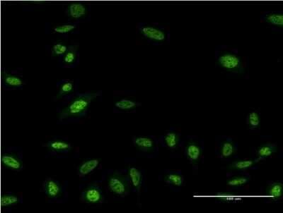 Immunocytochemistry/ Immunofluorescence: Olig2 Antibody (3C9) [H00010215-M03]