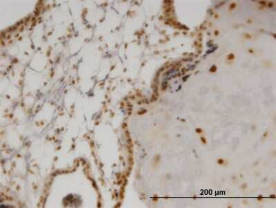 Immunohistochemistry-Paraffin: Olig2 Antibody (3C9) [H00010215-M03]