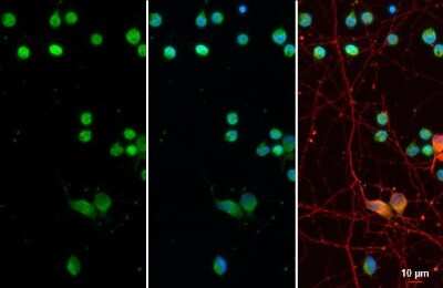 Immunocytochemistry/ Immunofluorescence: Olig2 Antibody (HL1072) [NBP3-13712]