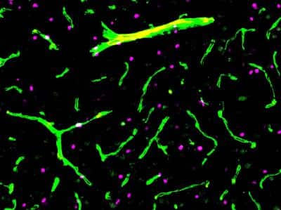 Immunohistochemistry-Frozen: Olig2 Antibody - Azide and BSA Free [NBP1-28667]