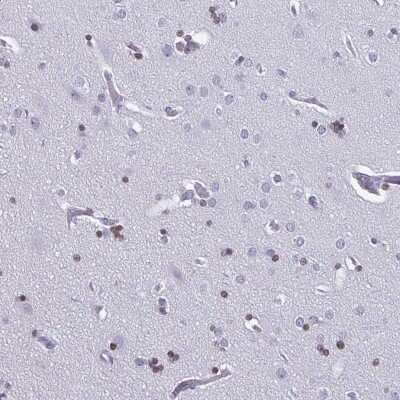 Immunohistochemistry-Paraffin: Olig2 Antibody [NBP1-88634]