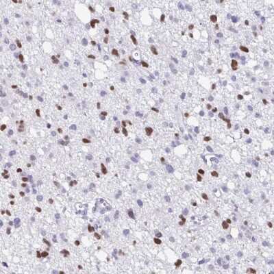 Immunohistochemistry-Paraffin: Olig2 Antibody [NBP1-88634]
