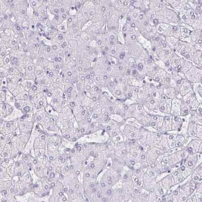 Immunohistochemistry-Paraffin: Olig2 Antibody [NBP1-88634]