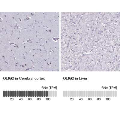 Immunohistochemistry-Paraffin: Olig2 Antibody [NBP1-88634]