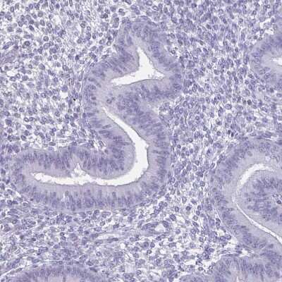 Immunohistochemistry-Paraffin: Olig2 Antibody [NBP1-88634]