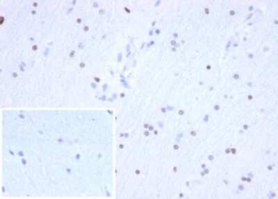 Immunohistochemistry-Paraffin: Olig2 Antibody (OLIG2/6695R) [NBP3-13830]