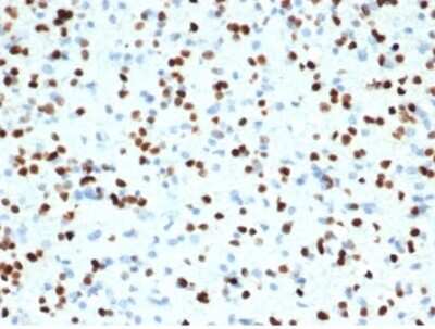 Immunohistochemistry-Paraffin: Olig2 Antibody (OLIG2/7074R) [NBP3-13831]