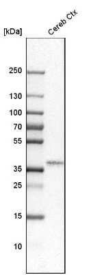 Western Blot: Olig2 Antibody [NBP1-88634]