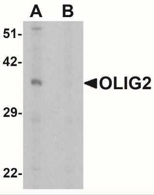 Western Blot: Olig2 AntibodyBSA Free [NBP2-41269]
