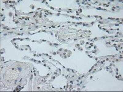 Immunohistochemistry-Paraffin: Oncostatin M/OSM Antibody (OTI2B6) [NBP1-47904]