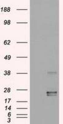Western Blot: Oncostatin M/OSM Antibody (OTI2B6) [NBP1-47904]