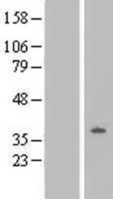 Western Blot: ORL1/OPRL1 Overexpression Lysate [NBL1-13944]