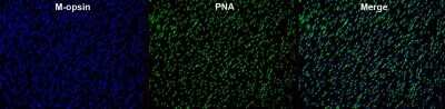 Immunohistochemistry: Opsin 1 (Medium Wave) Antibody [NB110-74730]