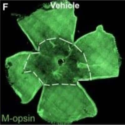 Immunohistochemistry: Opsin 1 (Medium Wave) Antibody [NB110-74730]