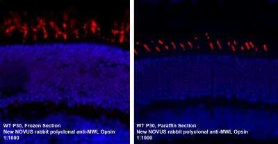 Immunohistochemistry-Paraffin: Opsin 1 (Medium Wave) Antibody [NB110-74730]