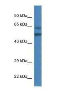 Western Blot: Optimedin Antibody [NBP1-74249]
