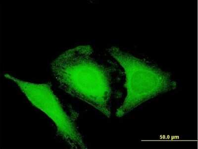 Immunocytochemistry/ Immunofluorescence: Optineurin Antibody [H00010133-B01P]