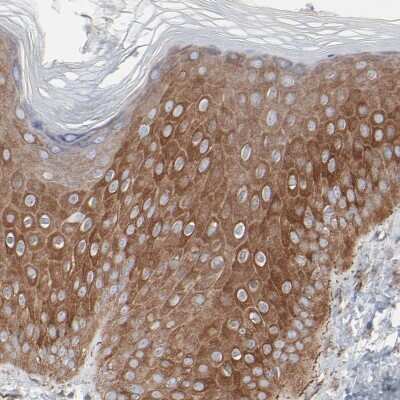 Immunohistochemistry-Paraffin: Optineurin Antibody [NBP1-84682]