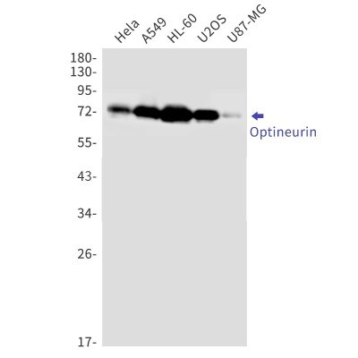 Western Blot: Optineurin Antibody (S01-2C5) [NBP3-19900]