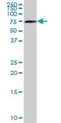 Western Blot: Optineurin Antibody [H00010133-B01P]