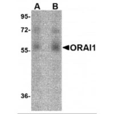 Western Blot: Orai1 Antibody (3F6H5)BSA Free [NBP1-75522]