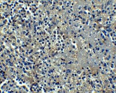 Immunohistochemistry-Paraffin: Orai1 Antibody (6D11A11) - BSA Free [NBP1-75523]