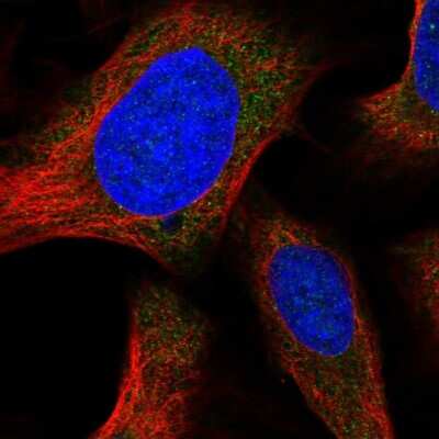 Immunocytochemistry/ Immunofluorescence: Orai1 Antibody [NBP2-57369]