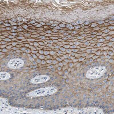 Immunohistochemistry-Paraffin: Orai1 Antibody [NBP1-85463]
