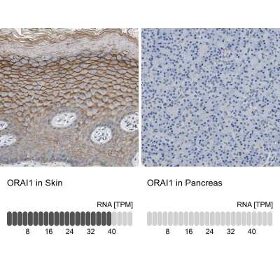 Immunohistochemistry-Paraffin: Orai1 Antibody [NBP1-85463]