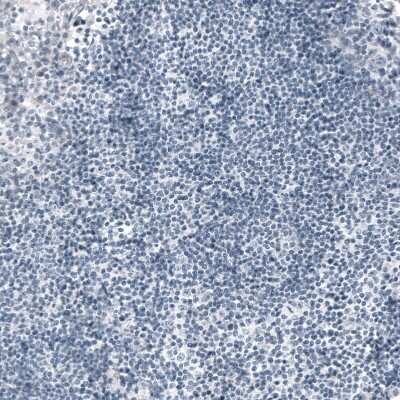 Immunohistochemistry-Paraffin: Ornithine Carbamoyltransferase Antibody (CL4045) [NBP2-59038]