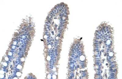 Immunohistochemistry: Ornithine Carbamoyltransferase Antibody [NBP1-54934]