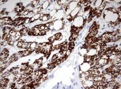 Immunohistochemistry: Ornithine Carbamoyltransferase Antibody (OTI8A1) - Azide and BSA Free [NBP2-73149]