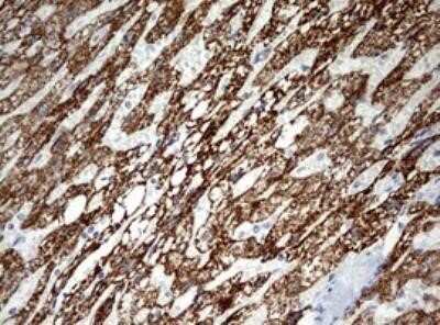 Immunohistochemistry: Ornithine Carbamoyltransferase Antibody (OTI8A1) - Azide and BSA Free [NBP2-73149]