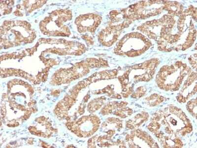 Immunohistochemistry-Paraffin: Ornithine Decarboxylase Antibody (ODC1/2878R) - Azide and BSA Free [NBP3-08791]