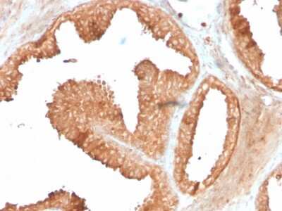 Immunohistochemistry-Paraffin: Ornithine Decarboxylase Antibody (ODC1/3636R) - Azide and BSA Free [NBP3-08792]