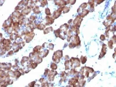 Immunohistochemistry-Paraffin: Ornithine Decarboxylase Antibody (ODC1/485) - IHC-Prediluted [NBP2-44732]