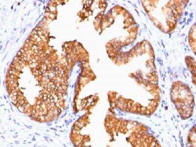 Immunohistochemistry-Paraffin: Ornithine Decarboxylase Antibody (ODC1/485) [NBP2-32887]