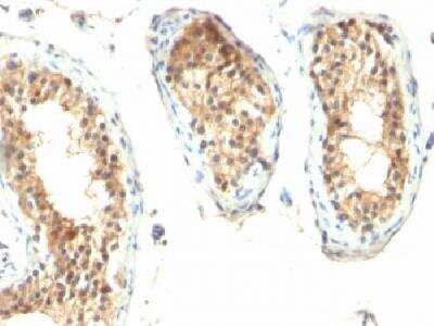 Immunohistochemistry-Paraffin: Ornithine Decarboxylase Antibody (ODC1/485) [NBP2-32887]