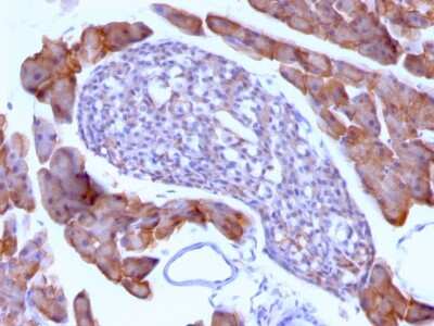 Immunohistochemistry-Paraffin: Ornithine Decarboxylase Antibody (ODC1/485) [NBP2-32887]