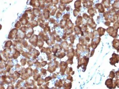 Immunohistochemistry-Paraffin: Ornithine Decarboxylase Antibody (ODC1/486) - Azide and BSA Free [NBP2-47836]