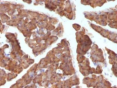 Immunohistochemistry-Paraffin: Ornithine Decarboxylase Antibody (ODC1/486) - Azide and BSA Free [NBP2-47836]