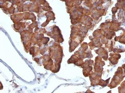 Immunohistochemistry-Paraffin: Ornithine Decarboxylase Antibody (ODC1/487) - Azide and BSA Free [NBP2-47837]