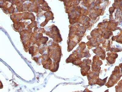 Immunohistochemistry-Paraffin: Ornithine Decarboxylase Antibody (ODC1/487) - IHC-Prediluted [NBP2-48322]