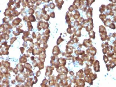 Immunohistochemistry-Paraffin: Ornithine Decarboxylase Antibody (ODC1/487) [NBP2-44735]